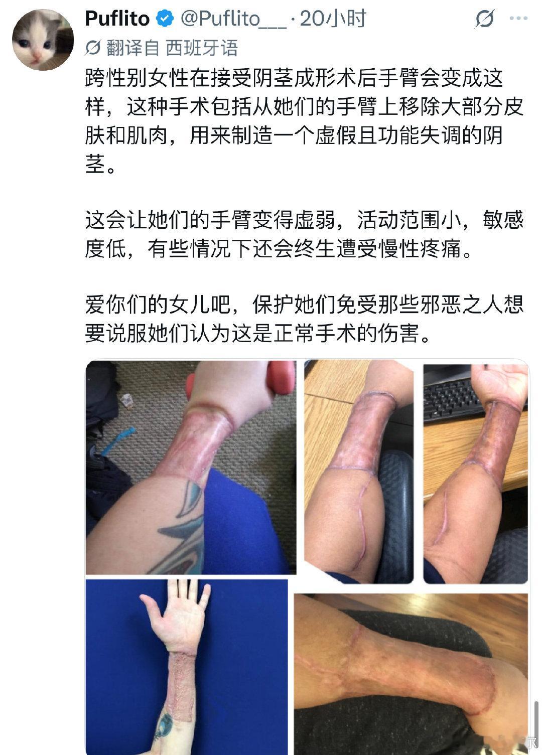 那马斯克大儿子.....
#流汗黄豆的瞬间# ​