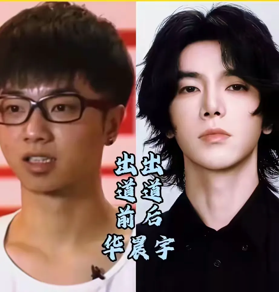 出道20年，蔡依林的脸怎么突然就紧了？没人敢说的大实话被一个医师掀了桌。
林建宏直接甩出对比照，指出她早年牙齿暴、嘴巴闭不紧，是靠正畸把下半张脸彻底拉回正确位置。
中间那几年，她脸僵、嘴歪，粉丝硬说是红气养人。官方也从不认，只说健身、消婴儿肥、造型升级。
可牙齿一动，唇形、下巴、法令纹全跟着变