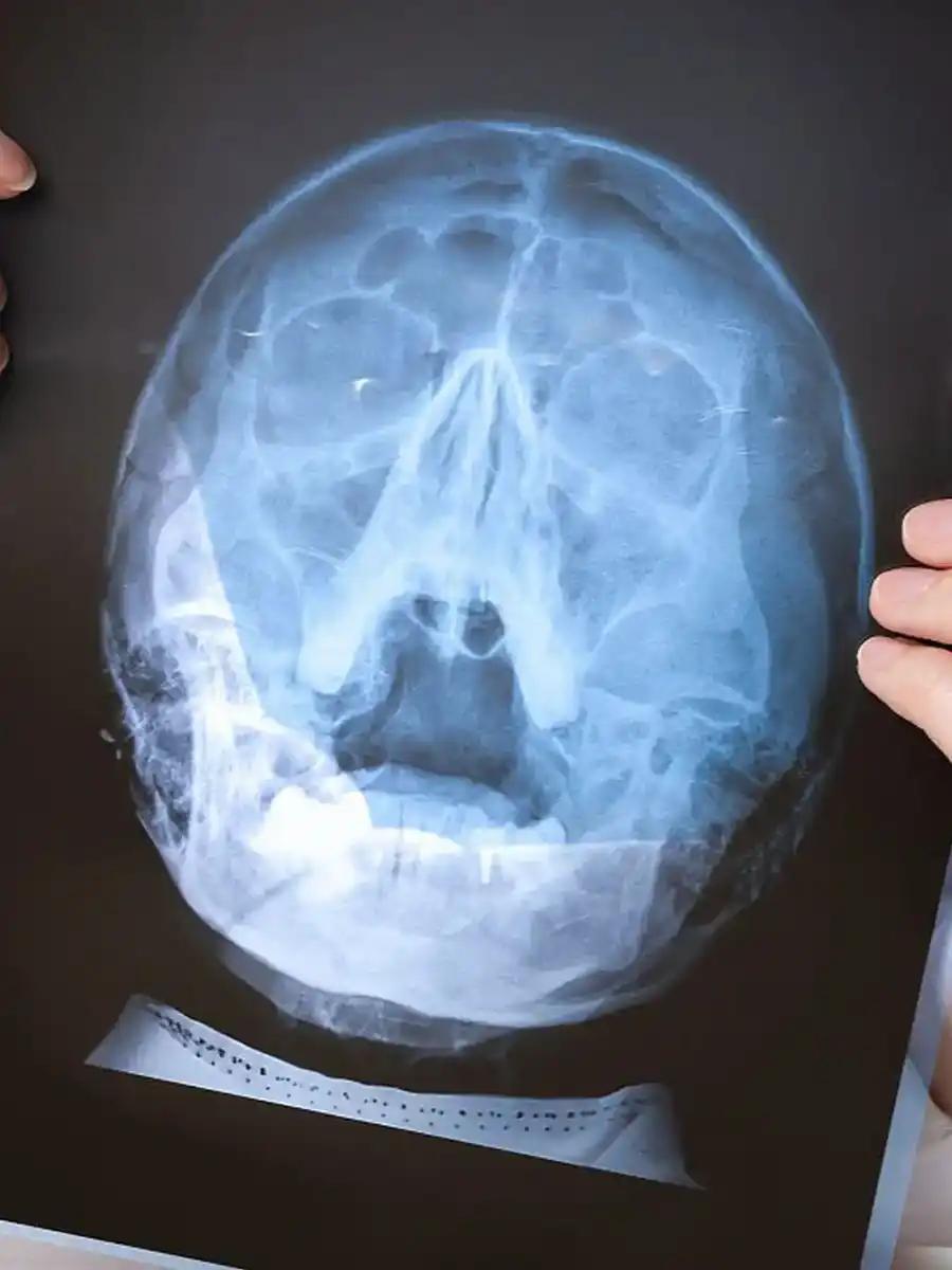 看病不用反复拍片化验了 ​