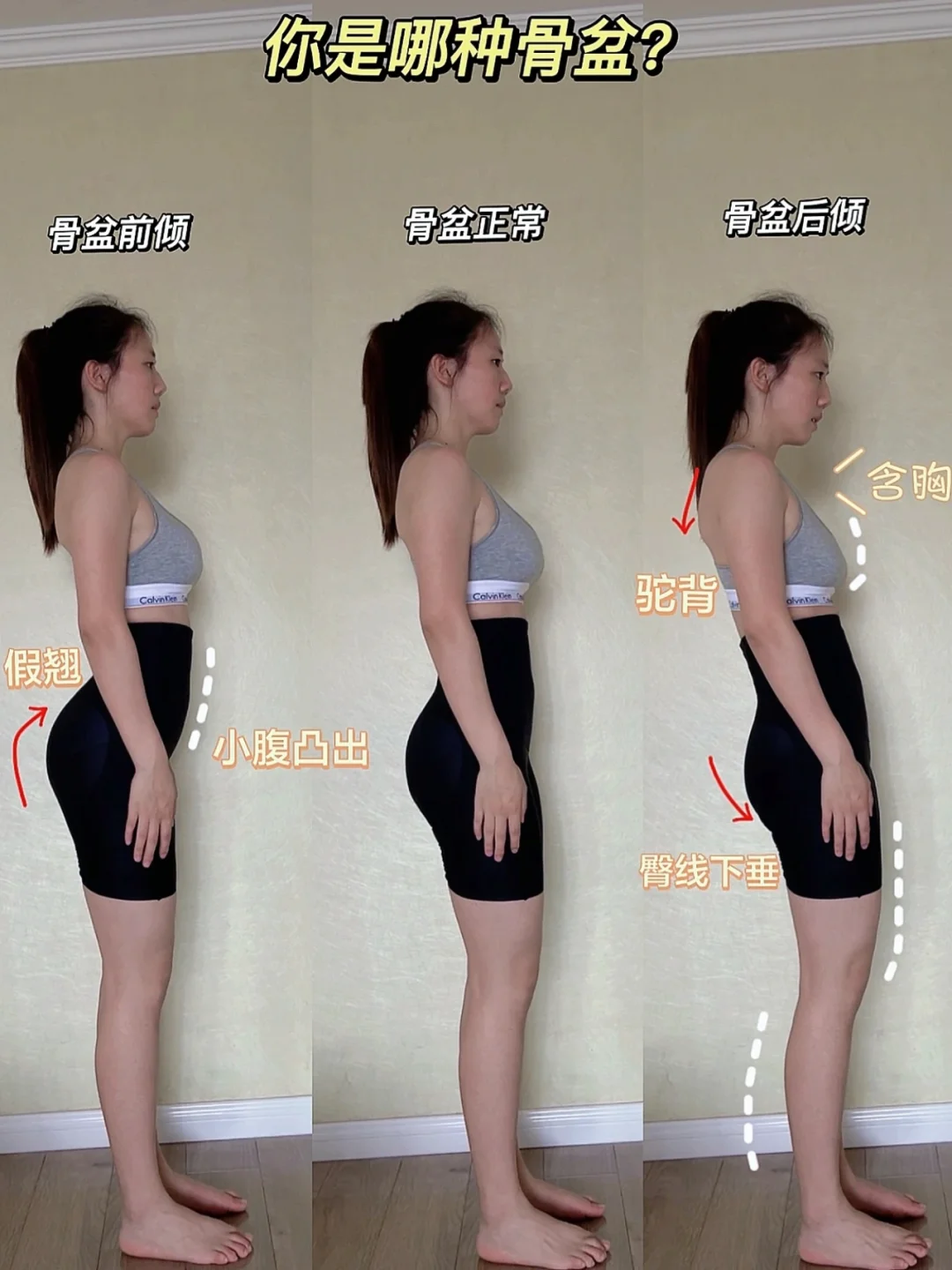 我悟了！骨盆归正可以解决一大半臀型问题！