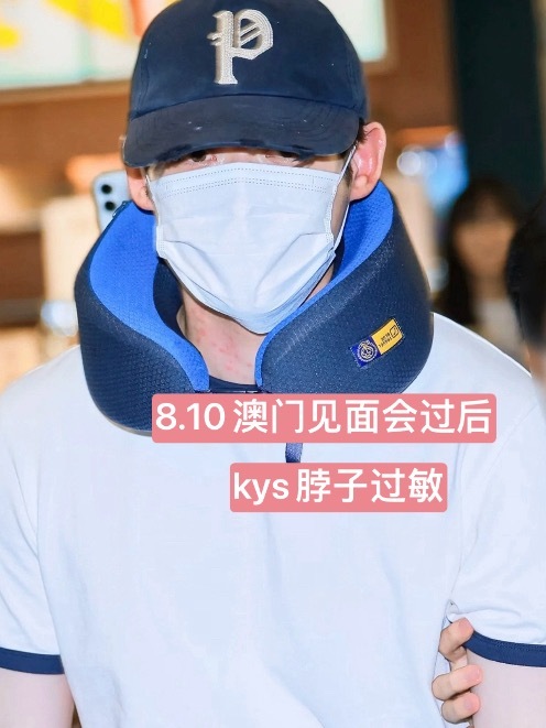 口香糖分析【莫名其妙知道了11号psy去见了kys】
视签问题：【你们之间的关系用一个词语形容】
金允植：“口香糖”
朴时宇：“是我的candy”
8.10澳门见面会结束 金允植脖子过敏
8.11去看医生 晚上kys的泡泡突然说三植像“口香糖” ？？？？三植怎么会是口香糖呢？
结合845的泡泡说“要推迟一会工作 ”
 ​