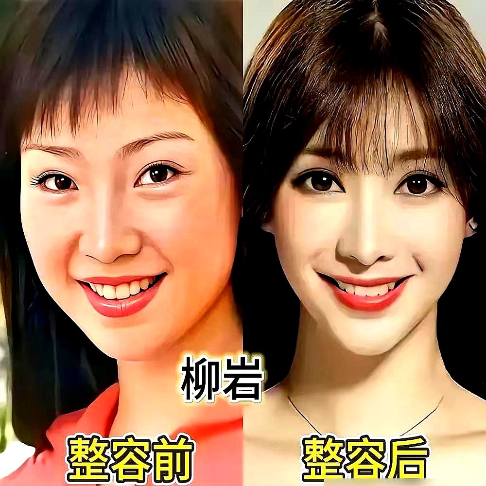 何炅在镜头前猝不及防扔出一句，你是不是每天都在微调？

沈梦辰眼皮都没眨，直接把老底掀了个底朝天。她指着脸比划，说早年填多了，脸僵得像木板，后来硬是靠溶脂和取假体才救回来。

这番底裤式的爆料，硬是把嘲讽堵在了网友嗓子眼里，换来满屏点赞。回看当年另一位女星被扒出旧照，死咬着说是减肥，结果路人缘碎了一