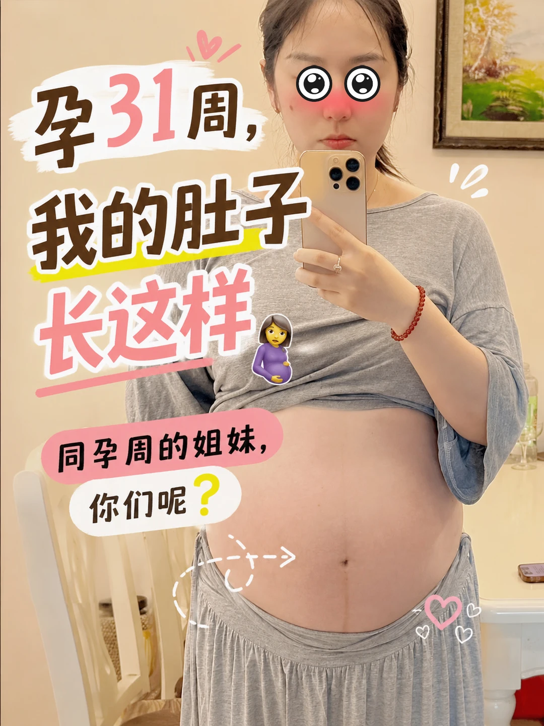 孕31周是什么肚型？真的有个人在肚子里🤰