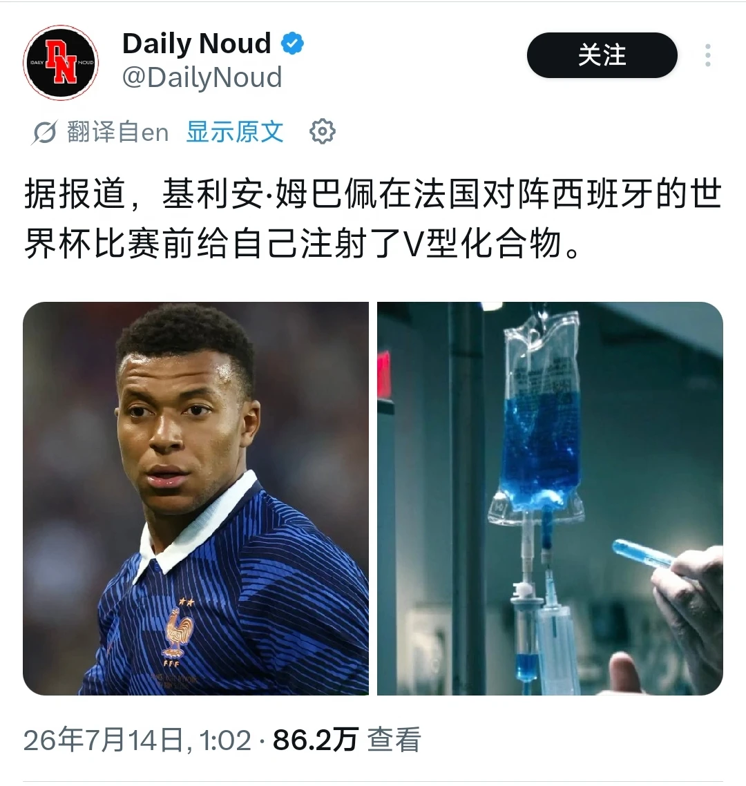 这是啥？？