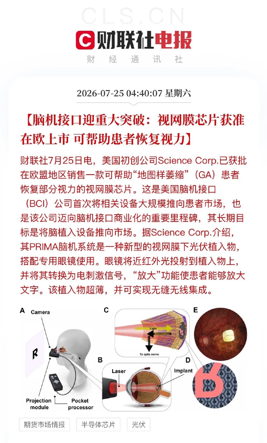 脑机接口应用这下真的照进现实了！中美脑机前沿研究均不断取得突破：脑机信...