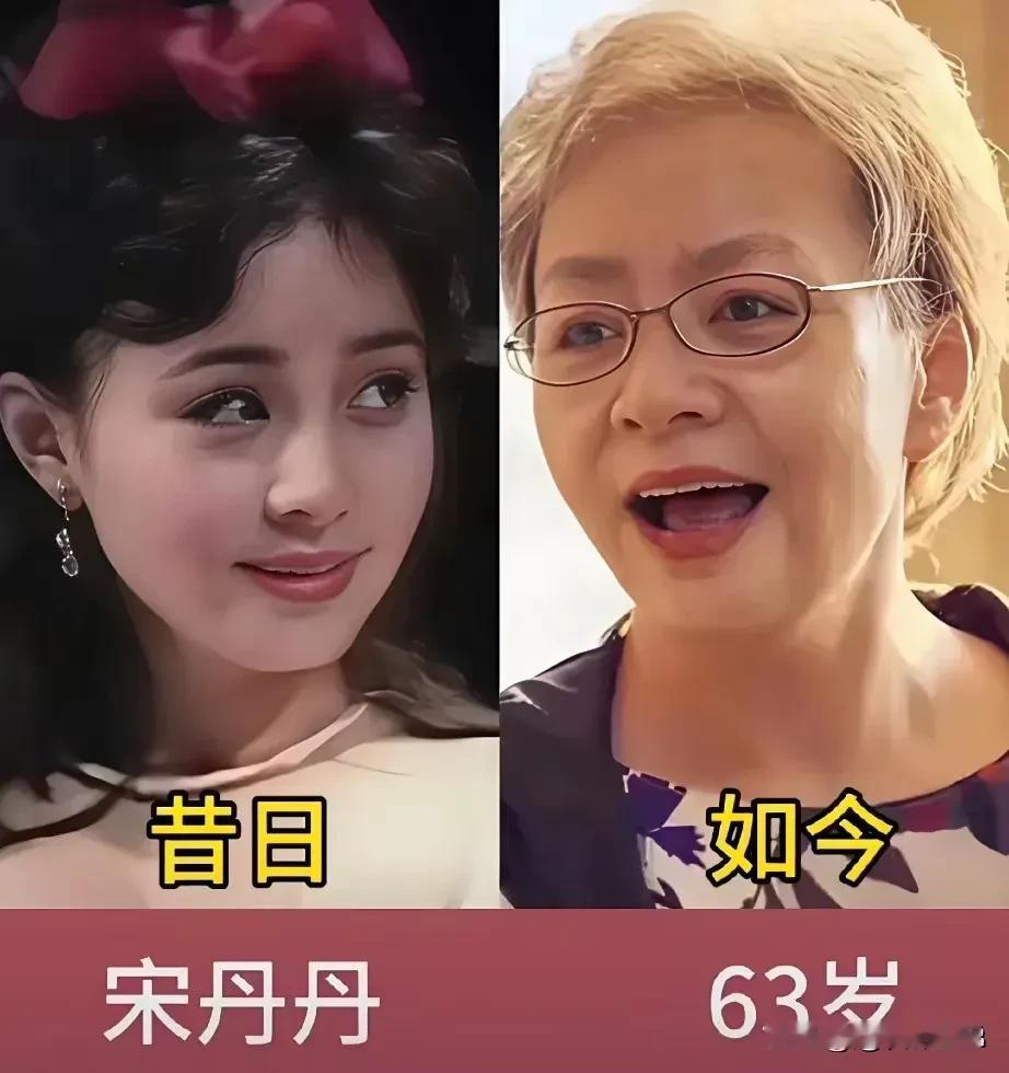 各有各美
宋丹丹年轻时五官端正，甜美文静，和后来的喜剧形象反差挺大。
潘虹年轻时气质出众，像从书里走出来的清冷美人。
她们年轻时美得各有千秋，如今老了也依然体面，这就是好底子。