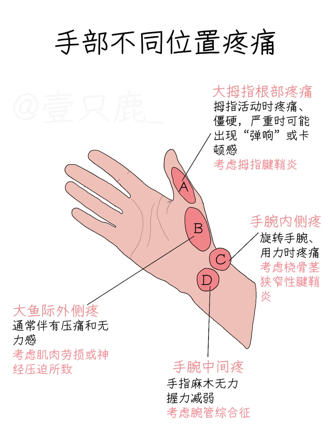 医学生笔记📝｜手痛