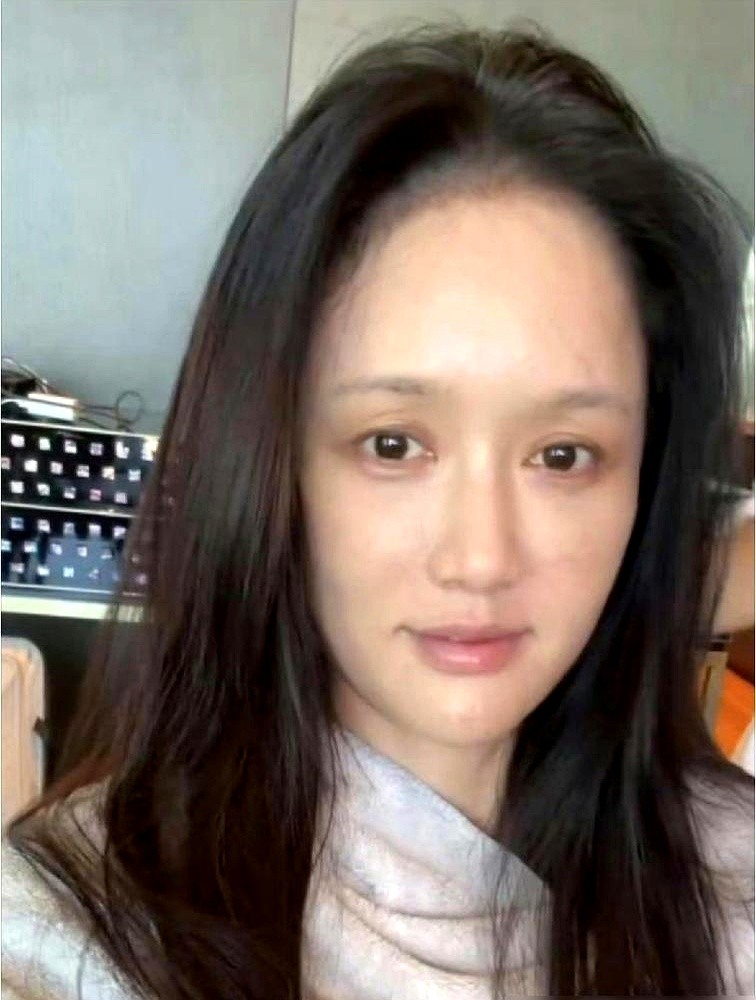 顶着稀疏的眉毛和黑眼圈，45岁的陈乔恩直接瘫在沙发上。

照片一甩，评论区当场裂成两半。有人盯着她额头上的闭口和后退的发际线疯狂敲键盘，喊着偶像精气神全无。

她连个滤镜都懒得套，搂着猫窝着，把中年人的疲态硬生生推到几千万人眼前。不用死撑着凹少女人设，底子摆在那，骨相一分没垮。

敢把这副模样亮出来