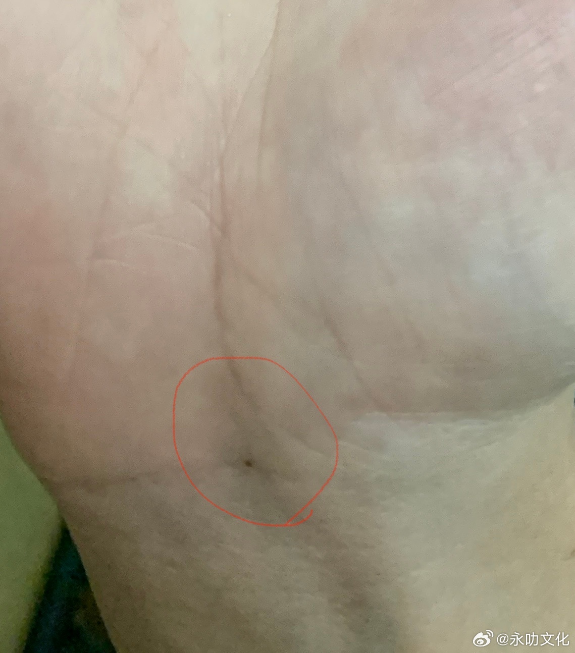 手腕处如图画圈位置，如果低凹或发青或有痣，代表肾阳不足，女性要注意妇科问题，极容易长东西，男性要注意前列腺问题，另外也很容易长结石。面相小‬知识手相面相八字算命 ​​​