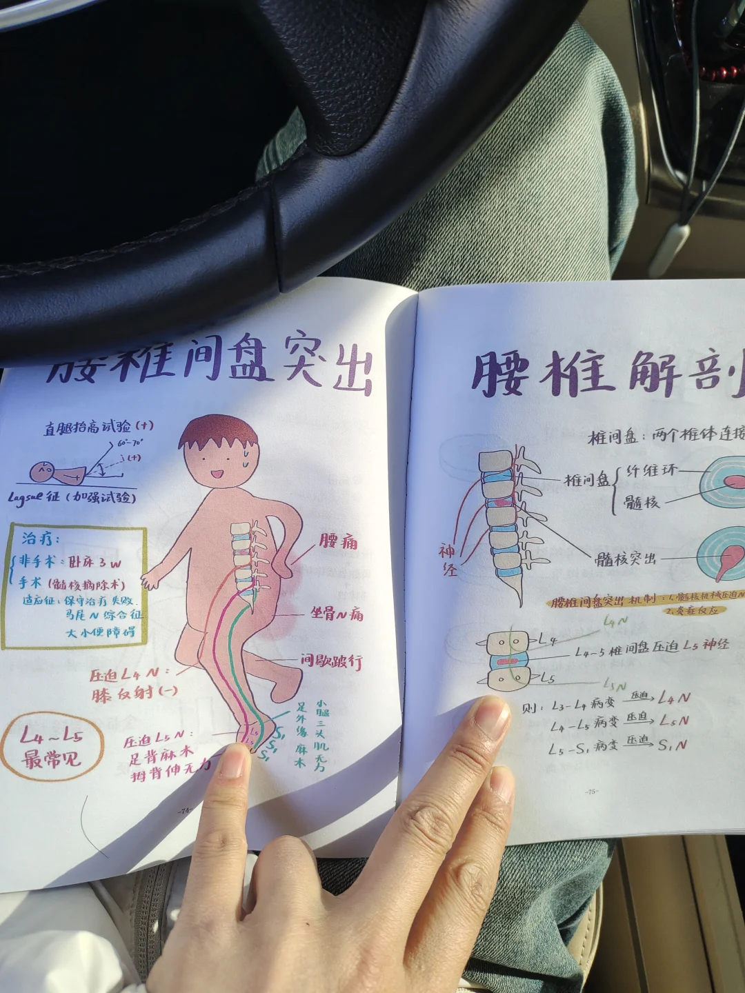 医学生规培笔记颈椎病