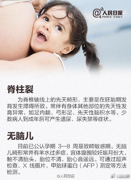 【如何预防孩子出生缺陷？】#原来大部分女儿都是遗传爸爸了#如何生育健康宝宝？预防孩子出生缺陷的三道防线是什么？了解出生缺陷预防知识！戳图↓↓#两小孩扮齐天大圣反被哮天犬追#（人民日报）#网友92万代孕孩子患自闭症# ​