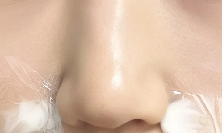 济州岛买的黑头溶解贴好好用啊啊啊啊啊啊啊