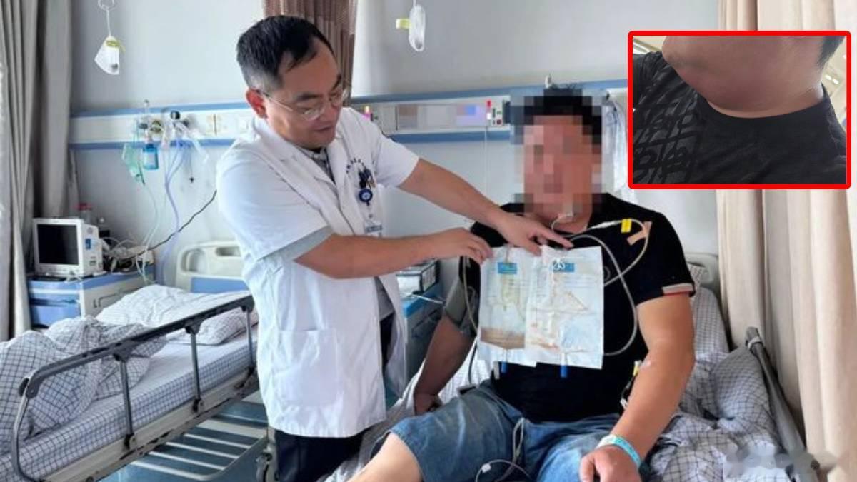 【杭州41岁司机牙痛拖成“颈部脓肿”，呼吸困难求医抽出800毫升脓液】牙痛不止惨过大病，还随时可能要命。浙江杭州一名41岁货车司机轻视牙痛，多日后痛到颈部，而且颈部明显肿胀，甚至出现吞咽及呼吸困难。求医后，医生在其颈部抽出逾800毫升脓液，指若再延误治疗，随时会窒息。

据杭州师范大学附属医 ​