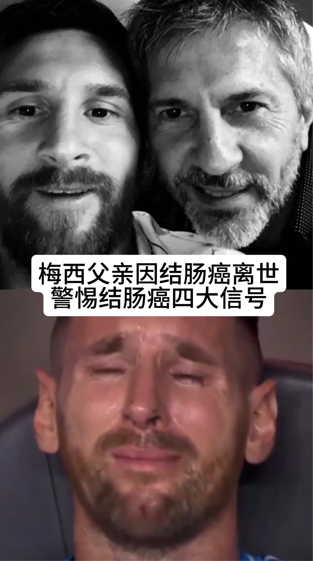 梅西父亲因结肠癌离世，警惕结肠癌四大信号