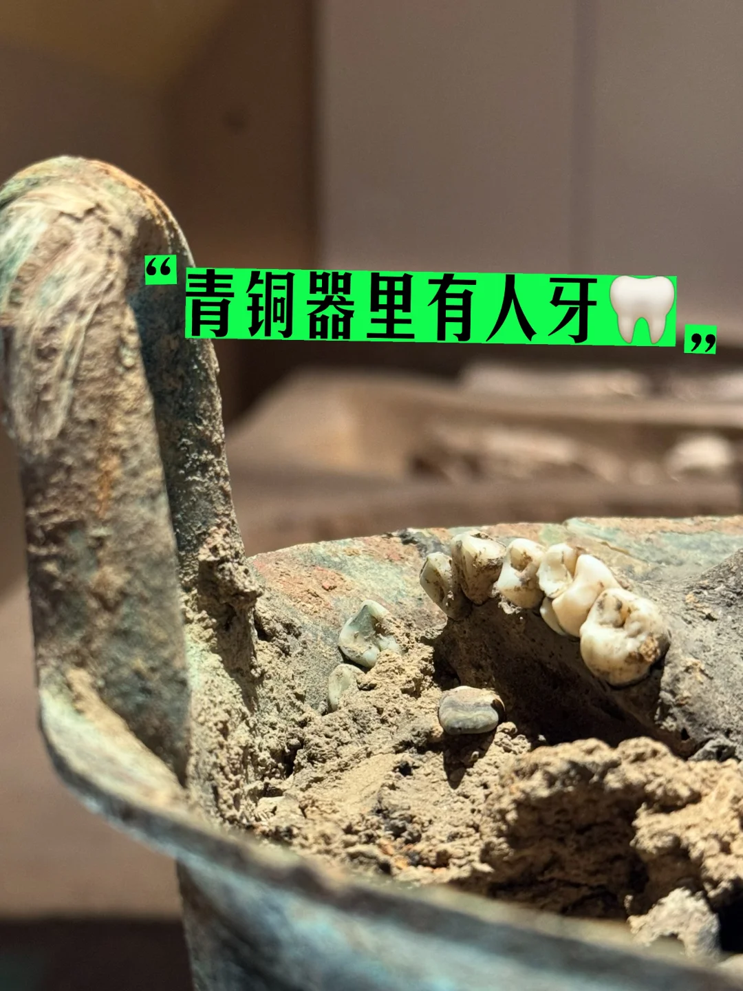 清明节，看着这铜锅里的牙，有点头皮发麻……