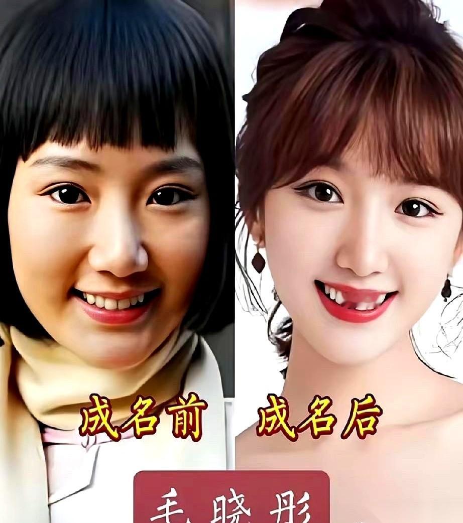 翻出十多年前的镜头录像，刘诗诗和毛晓彤刚露面的样子，跟现在几乎判若两人。
那时候站在镜头前，两人身上都带着一股藏不住的拘束。
早期的刘诗诗，话筒一递过来，下巴下意识往回收，肩膀紧紧绷着。台下十几个机位同时对准她，她的眼珠微微左右晃动，眼神里全是涉世未深的茫然，笑起来嘴角抿得发紧，像个被突然叫上讲台点