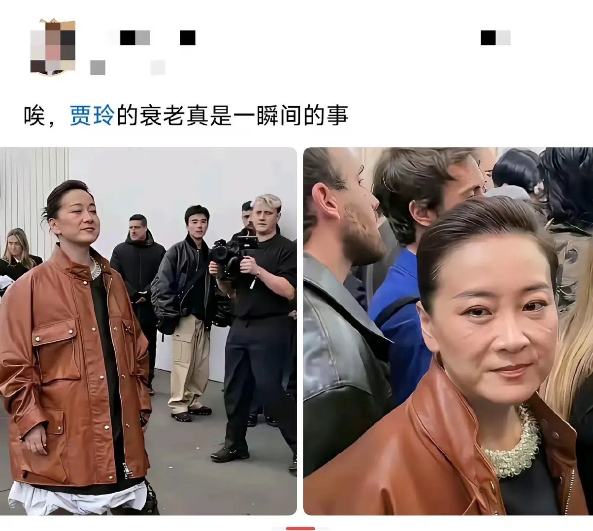 迅速减肥皮肤太松弛了，反弹也会很快 ​