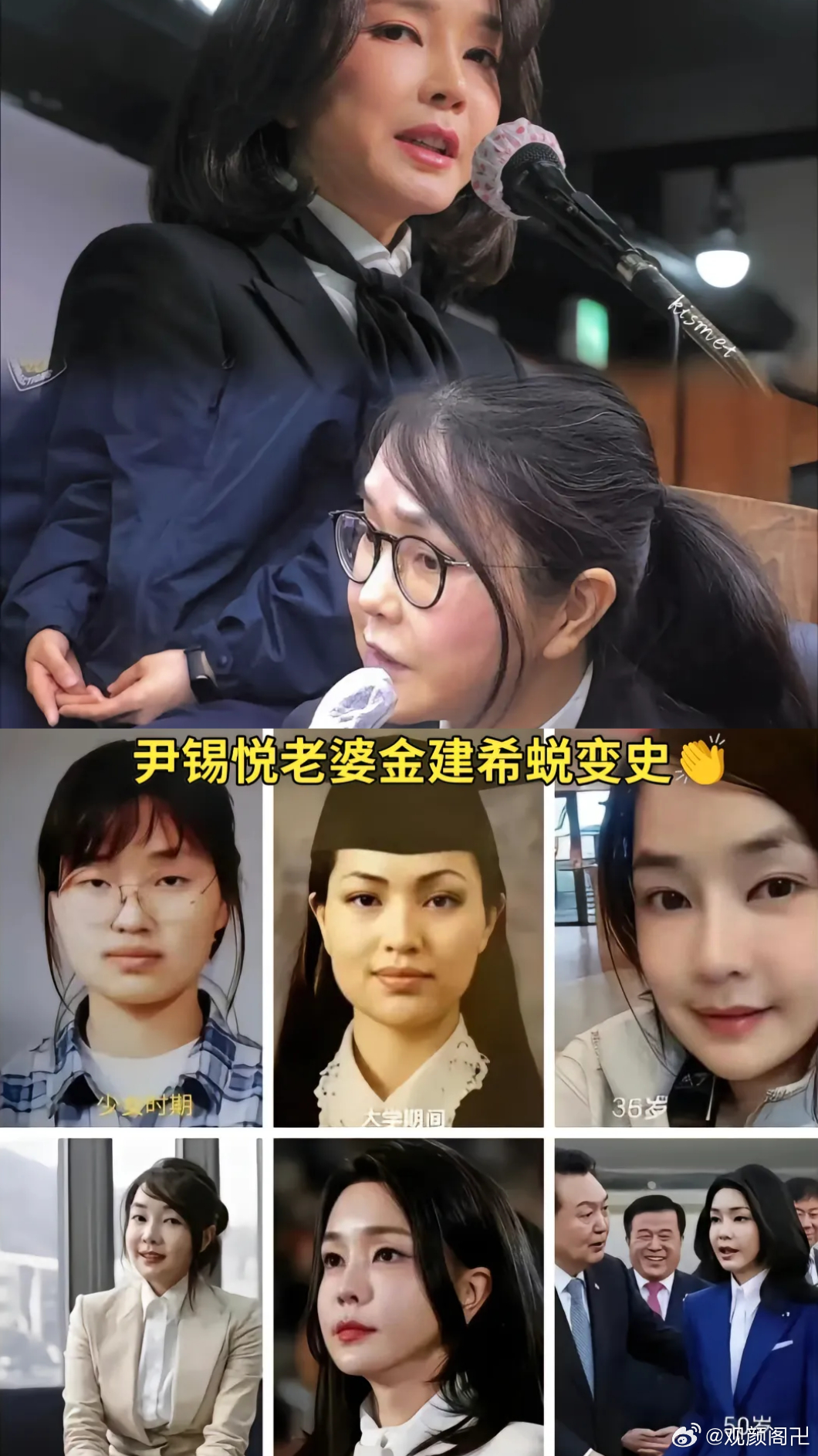 金建希这张脸，是韩国医美工业最极致的作品，也是最沉重的代价。

早年的她，偏宽偏方的脸型，单眼皮，肉少骨多，看着有一股子未经雕琢的土气和韧劲。而现在的她，变成了高颅顶、幼态鼻、饱满的苹果肌，标准的人工幼态脸模板。她只承认割了双眼皮，但明眼人一看就知道，这不仅是换了张脸，连带着底层的 ​