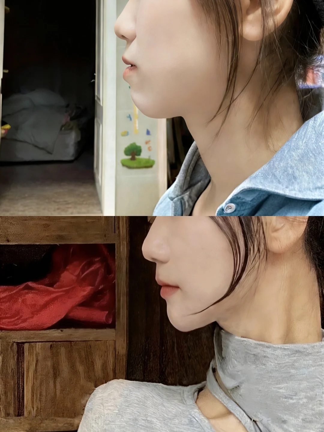 深圳整牙结束啦，已经戴一个月保持器了