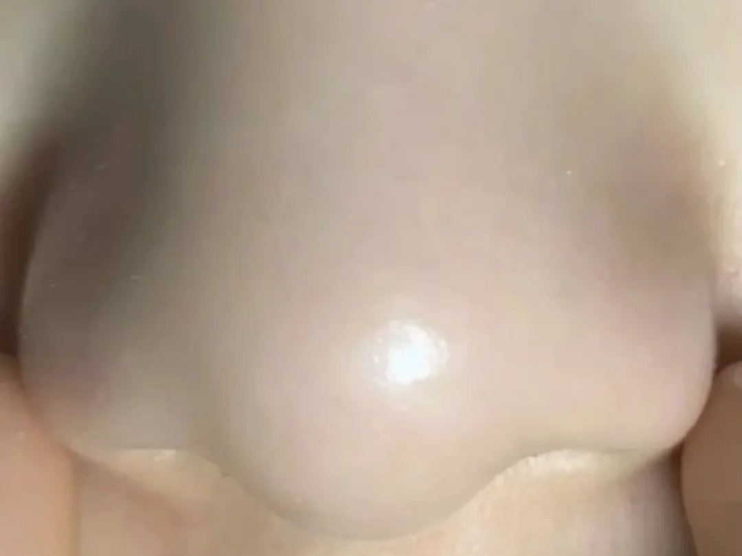 强推一个韩国的去黑头闭口神器！！！