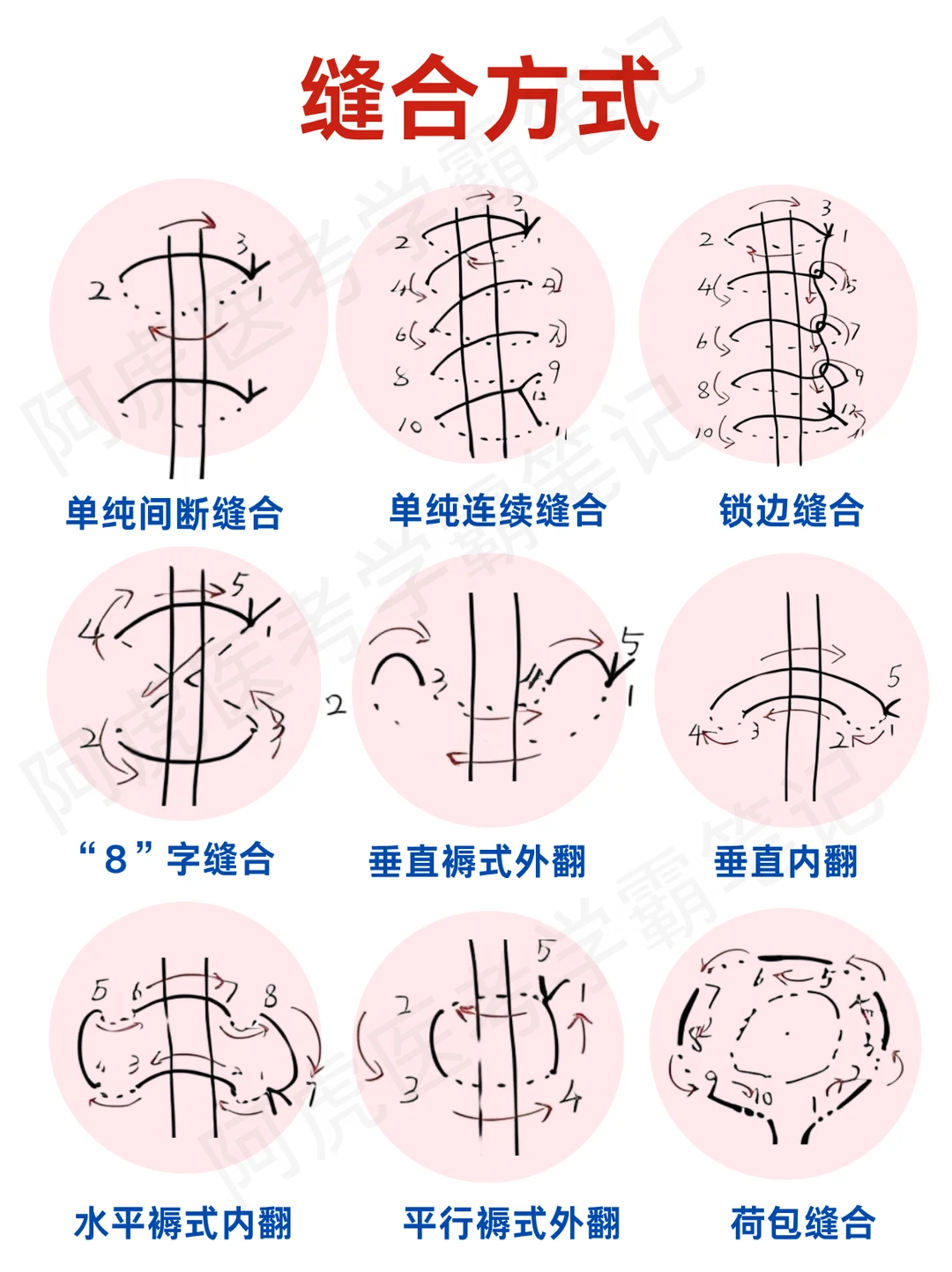 阿虎医考笔记📒简单易懂的缝合方式👆