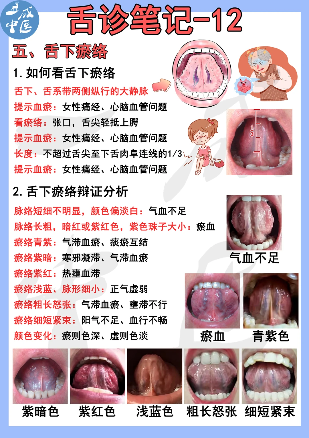 舌诊笔记-舌下瘀络！9-11页 舌下瘀络 1.如何看舌下瘀络 2.舌下...
