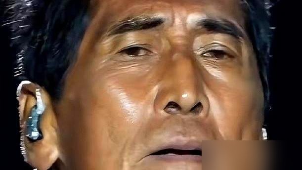 64岁齐秦，跑去美国把满口牙全换了，24颗，折腾整整一年。
不是矫情，是35年槟榔加老烟枪，牙早就烂透了。嘴里没几颗是自己的。
有人在美国尔湾拍到他，头发全白，下台阶得按着大腿慢慢挪。可转头又得飞去苏州、榆林接着唱，高音明显顶不上去了。
2011年那场烧伤，声带和呼吸道全伤了，能撑到现在已是硬