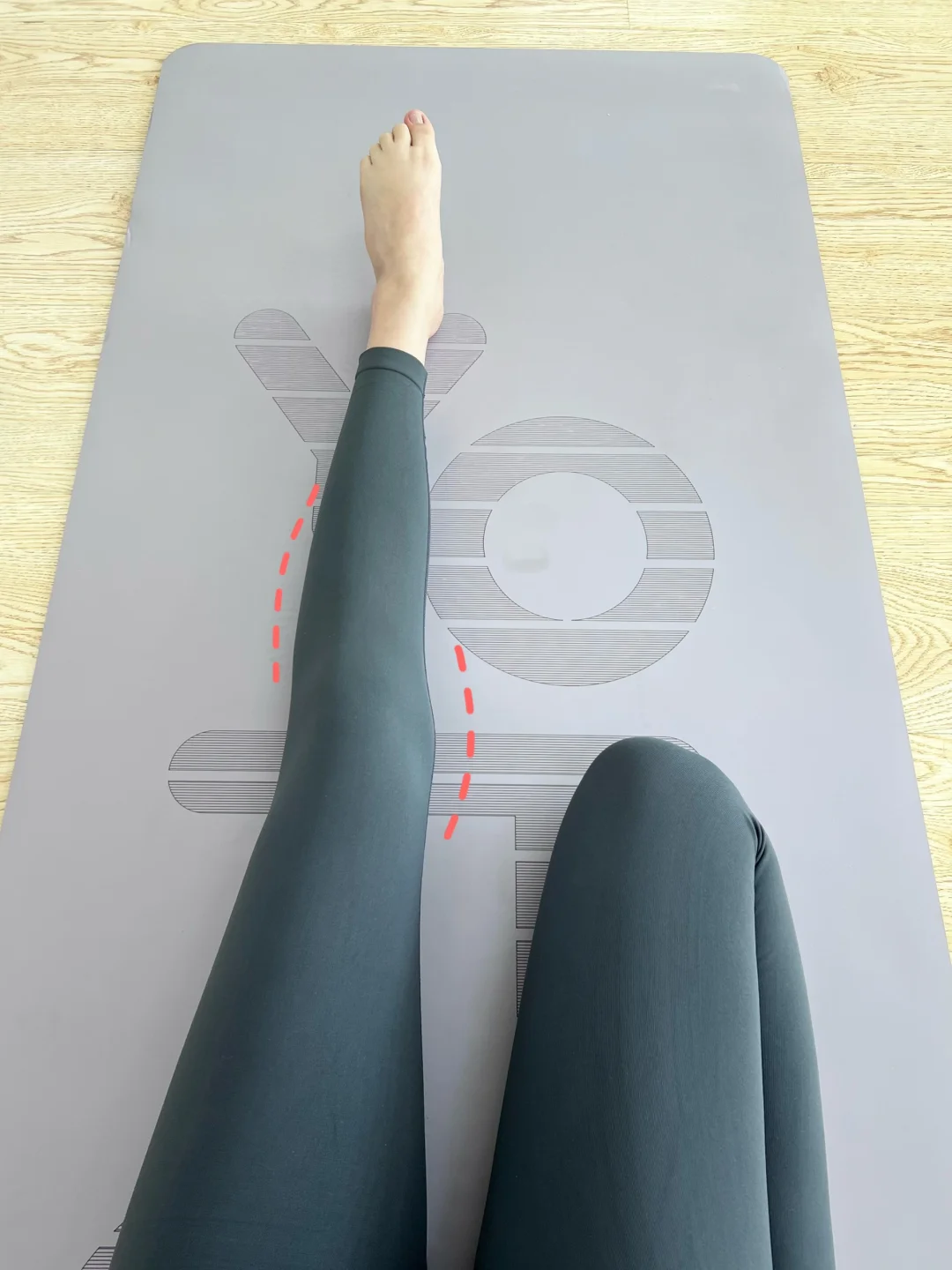 哇塞！膝盖内扣的姐妹快来练！腿直了！