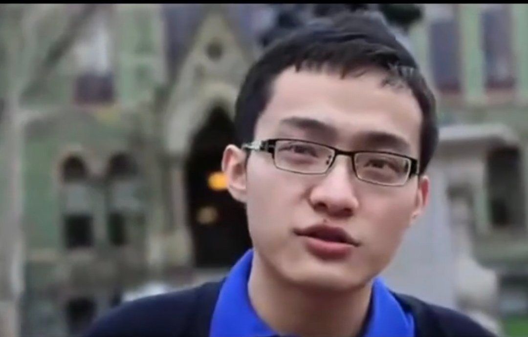 #这一步向平衡##国医的精诚力量# 孙宇晨，印堂不宽，早年上唇痣点了，上唇痣就是口舌是非痣，男科也是有问题的，唇周是泌尿生殖区。

没耳垂，能折腾，耳位低，耳朵小，嘴唇薄，没道德底线，法令纹很窄，很自私。 ​