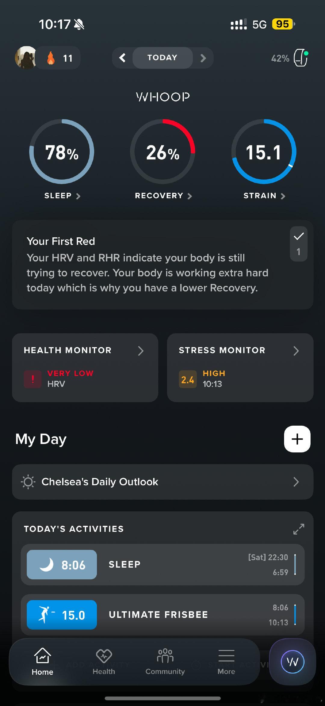 Day 2 
whoop已经连着两天给我发红色预警了[淡淡的]

双持Apple watch和whoop快两周
最大的感受就是带AW不能打盘和睡觉 whoop可以[无聊] ​