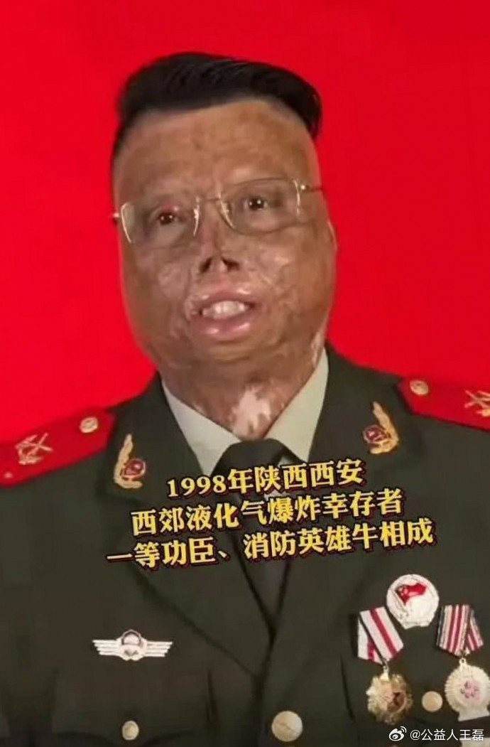 致敬消防英雄牛相成！其97%烧伤仍舍身救人的壮举，以无畏担当铸就一等功，生动彰显消防守护生命的崇高职责与高尚品格，是全体坚守职责、勇担使命的典范，值得深切缅怀与无限致敬！ ​