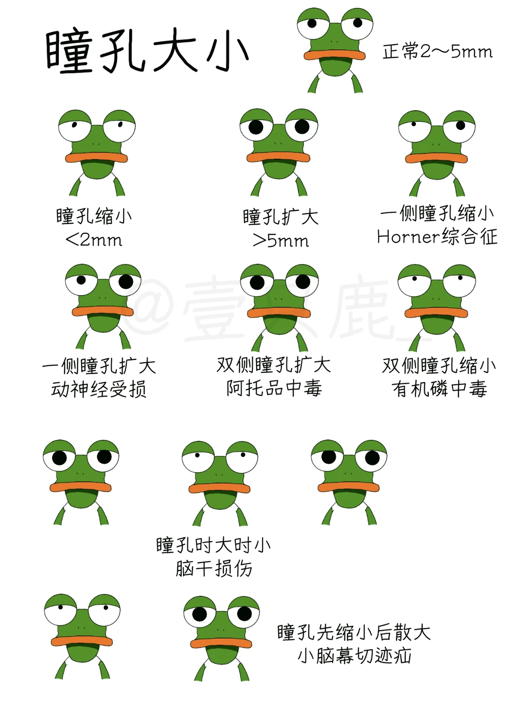医学生笔记📝｜揭秘瞳孔的秘密