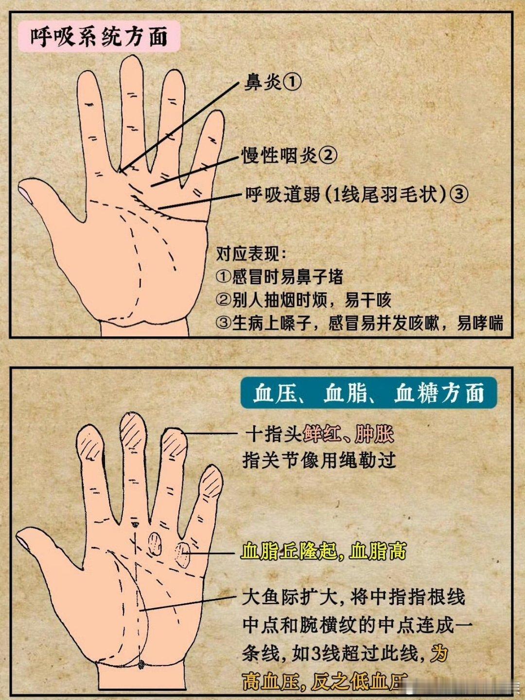 如何从掌纹线看健康状况？在中医理论中，手掌纹路属于“望诊”的范畴。《黄帝内经》有云：“视其外应，以知其内藏，则知所病矣。”手掌作为人体全息反射区之一，确实能反映气血盛衰和脏腑功能趋势，但掌纹仅作参考，不可替代四诊合参（望闻问切），更不能仅凭一条纹路妄下Z断（内容仅供参考哦） ​​​