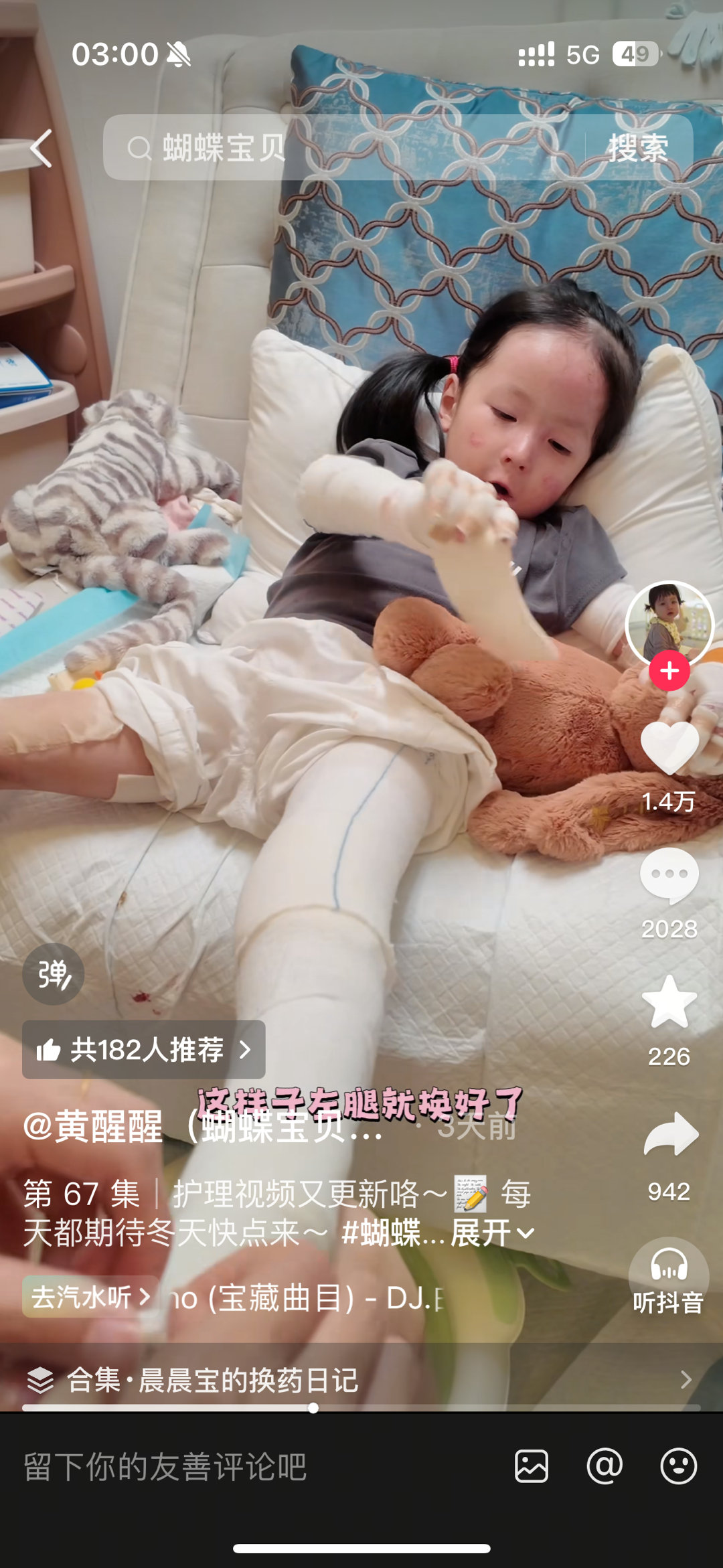 半夜刷到这个博主了，是一种罕见病，皮肤很容易溃烂，所以每天都要用敷料把几乎全身包住避免碰到。她一边很日常地配合妈妈换敷料一边说对怀里的玩偶说现在给痛苦的小兔子包上敷料[泪][泪][泪] ​