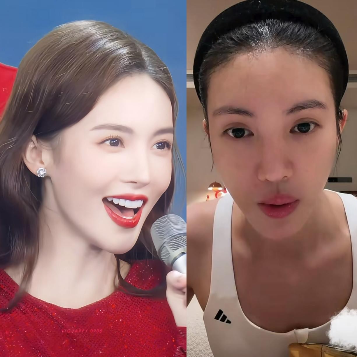点进金晨最新这场直播，很多人第一眼都没认出来，那道双眼皮未免太抢镜了。
镜头直接怼到脸部特写的时候，眼皮上的褶子明显宽了一大截，甚至带着点没消下去的肉条感。
以前她在《无心法师》或者早期红毯上，双眼皮虽然偏窄，但搭配那张小巧的脸，整个人笑起来灵动又透亮，辨识度拉满。
可现在的状态就显得有点怪异