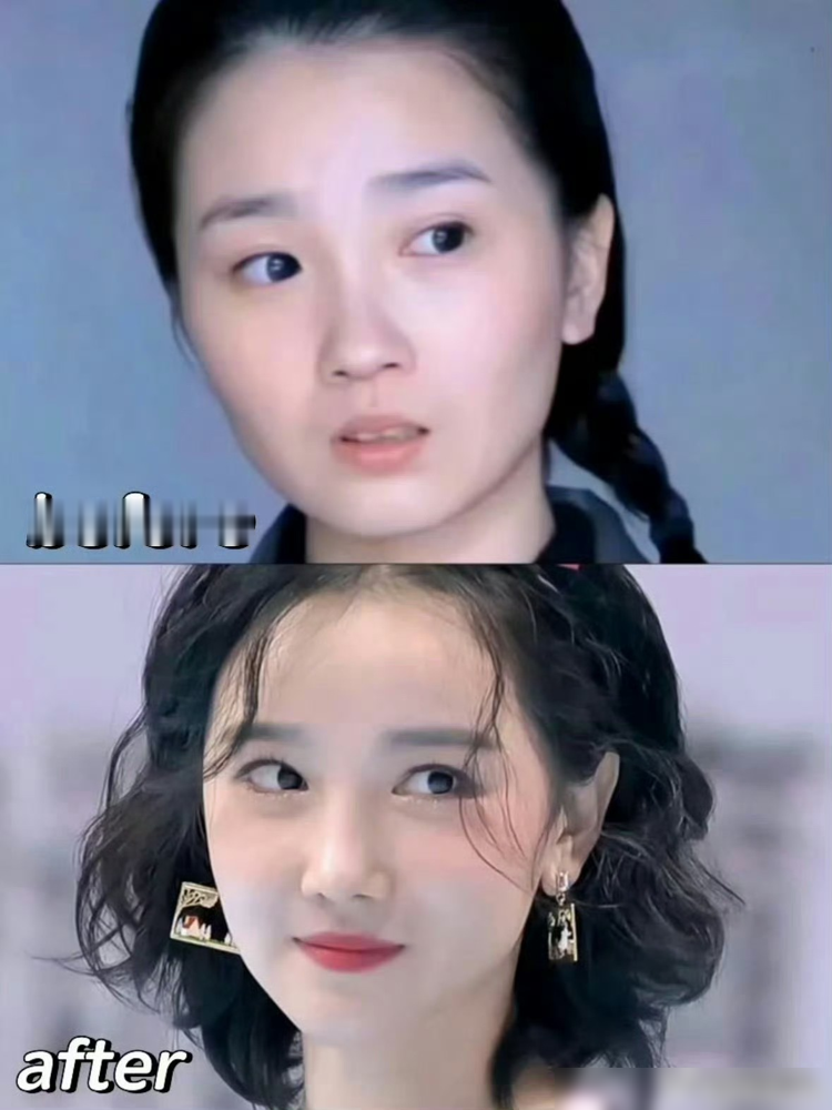 陈小纭在镜头前哭，边哭边说我都整了快十次了，每次都疼得想死。这不是卖惨，是她自己主动在综艺里往外抖的。她说学芭蕾练出来的狠劲儿，硬扛着把骨头往里推，为了脸窄一圈上镜好看。早上脸肿，她能先去跑四十分钟再开机。现在网友翻出射箭那会儿的图，说她脸僵了肿了，可那阵子恰恰是她自己说的推完没恢复的阶段。这姐们从