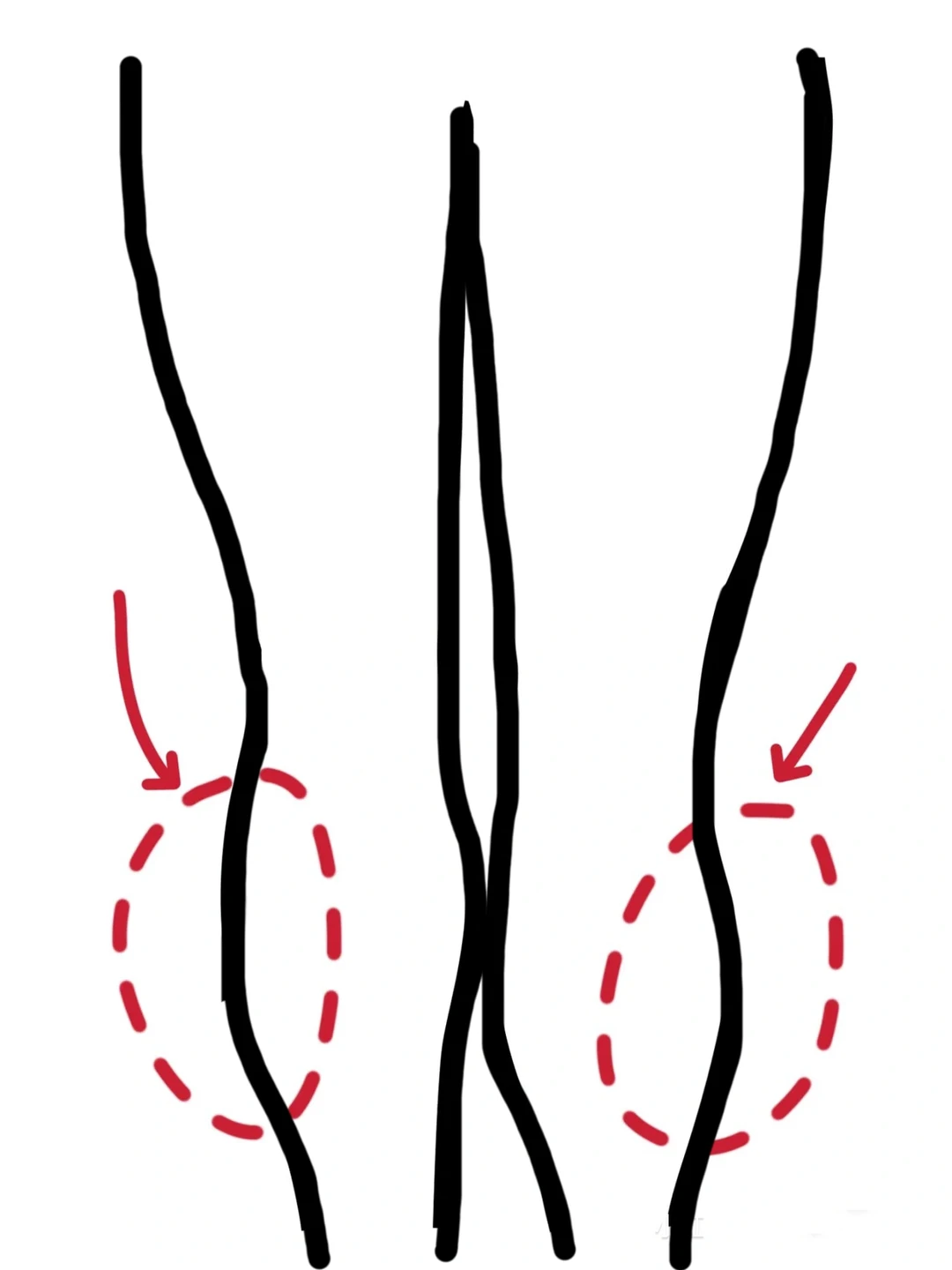 悟了！小腿外翻就练它