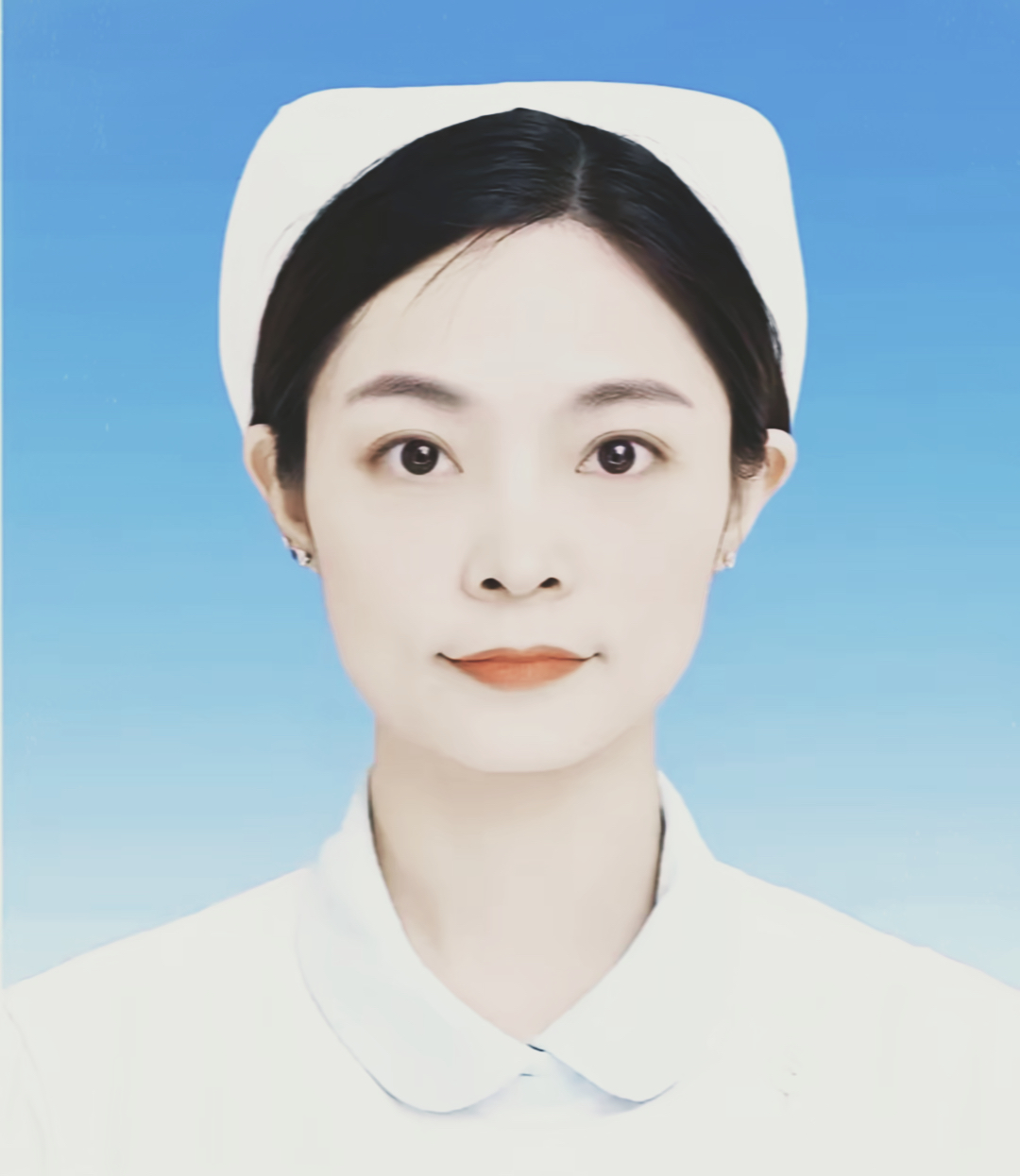 看完贵州茅台医院护士陈佳佳的这件事，真的让人心里特别难受！30岁的她，在上班期间突发头痛呕吐，还想着趴在工作台歇一会儿，同事察觉不对劲立刻送CT检查，确诊脑出血，紧急进行开颅手术，可惜最终还是没能挽回生命。


病历上写得很清楚，自发性蛛网膜下腔出血、脑室出血、急性脑疝，没有外伤，没有诱因，就是突然