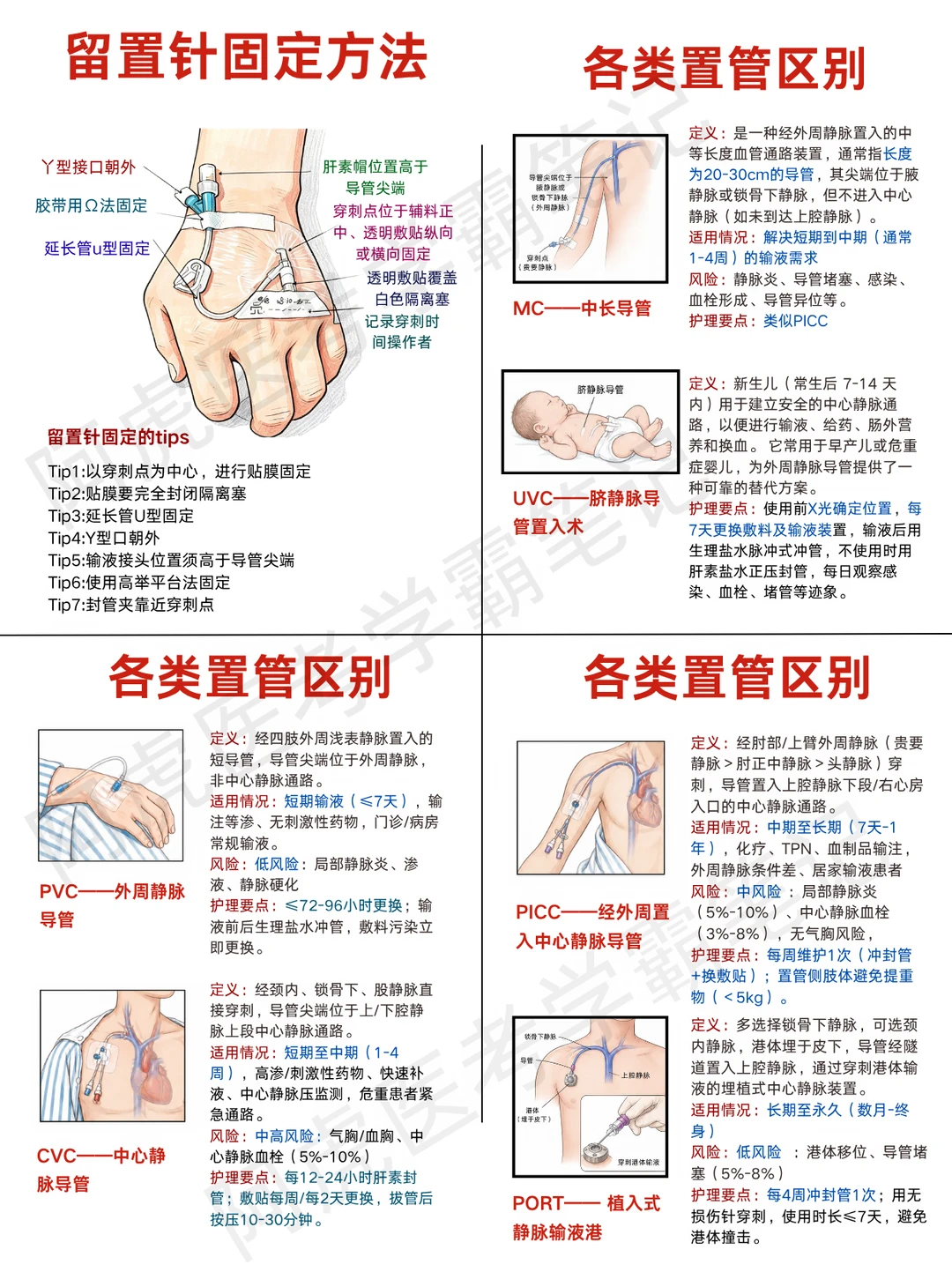 阿虎医考笔记📒留置针知识点合集❤️