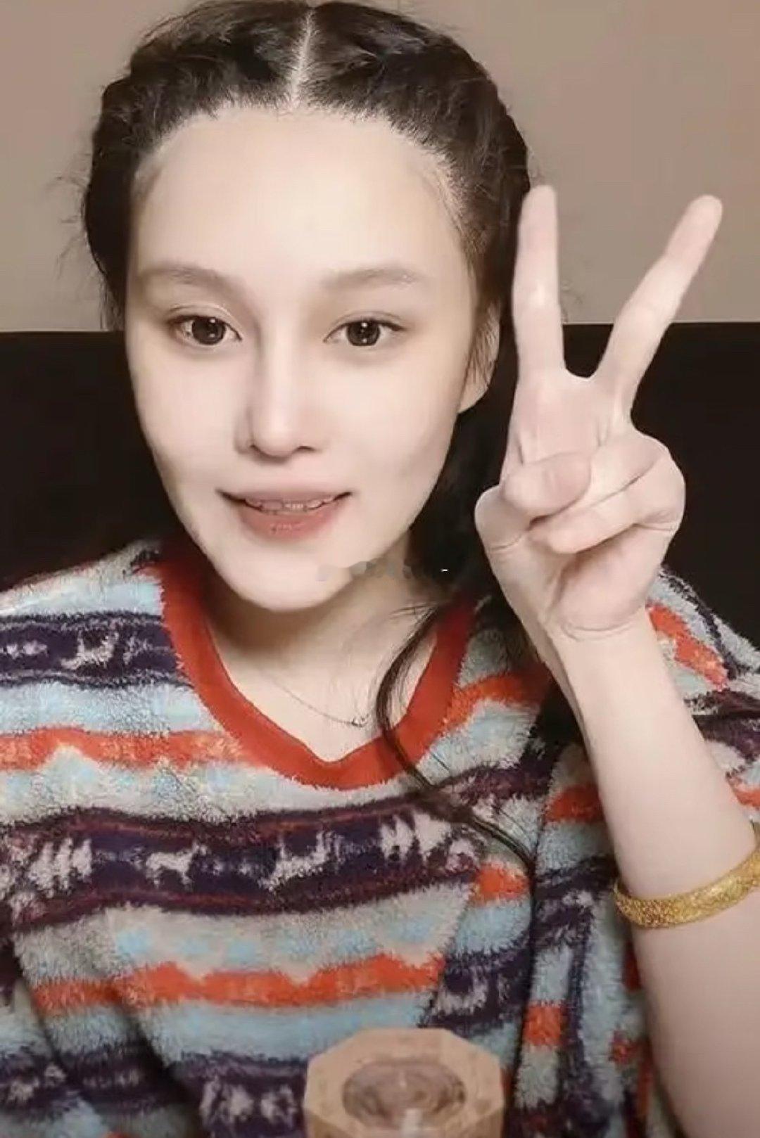 #赵本山女儿直播掉美颜#
球球直播意外关闭美颜滤镜，真实样貌曝光，脸型轮廓和赵本山高度相似，星二代基因太强大，褪去精致滤镜后，整个人气质接地气不少。 ​