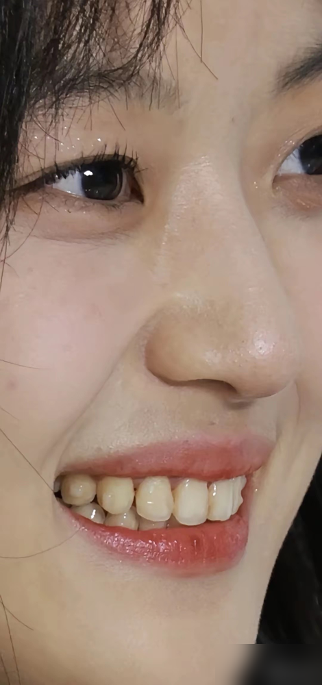 女演员的牙黄，居然把热搜给点爆了。孙千在《早春晴朗》里演尚之桃，一张嘴就是那口没动过的原生牙，微黄，甚至有点乱。换别人早去贴片美白了，她偏不。
还有那场刚毕业的戏，说话结巴，手指头绞着衣角，眼神躲闪。那股子没见过世面的局促感，根本不是演的。太像早高峰地铁里，那个抱着简历怕迟到的姑娘了。
这剧火到