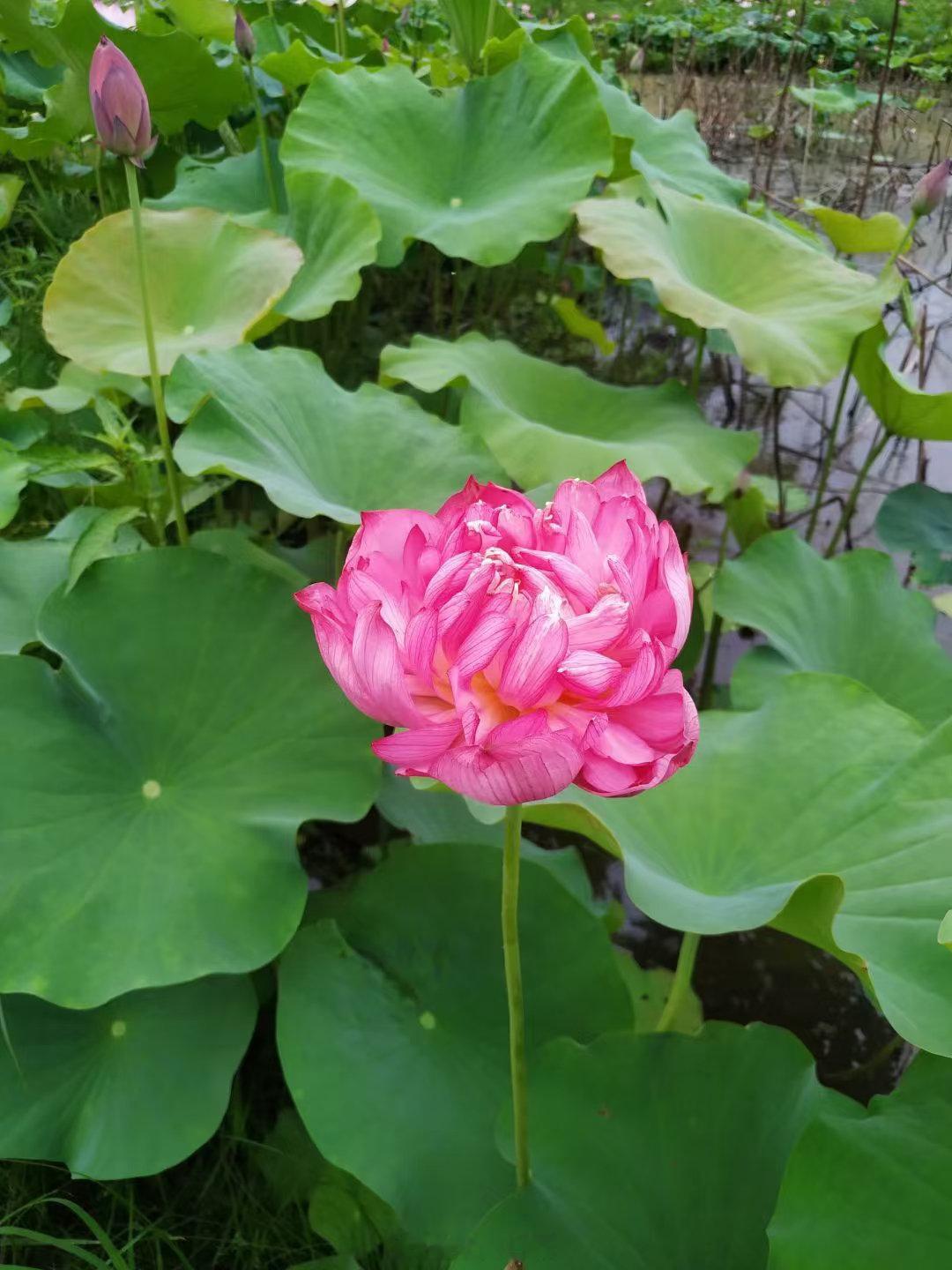 #很多癌症都源于慢性炎症背景# 

肝炎患者平时腹胀，腹泻，大便稀，不粘，这是典型的太阴病，应该用理中汤，如果用了很多茵陈蒿汤，板蓝根，虎杖等，这样的患者一定会硬化，最后变成肝癌。

#国医精诚的力量##中医学[超话]# ​