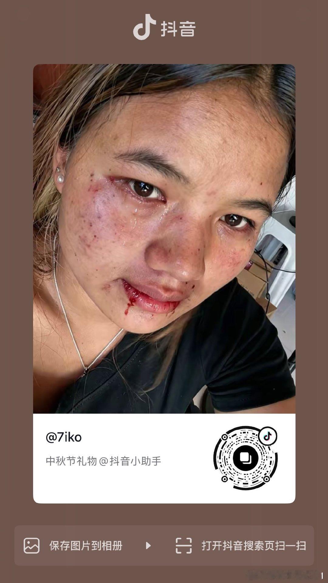 吃苹果的人王家股票跌，微软股票跌，陈家股票跌，英特尔跌，meta跌，博通股票跌，孙家股票跌，闪迪跌，徐家股票跌，刘家股票跌，中际旭创，美光科技股票跌，黄家股票跌，英伟达股票跌，台积电股票跌，超威股票跌，spacex股票涨，特斯拉股票涨 ​