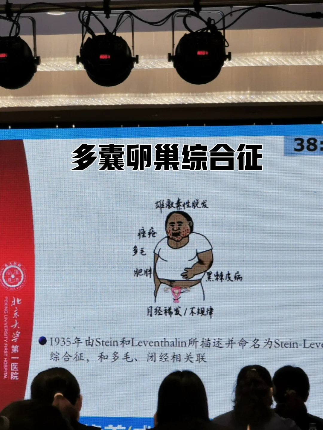 “代糖”不提供能量，但会让你胃口大开