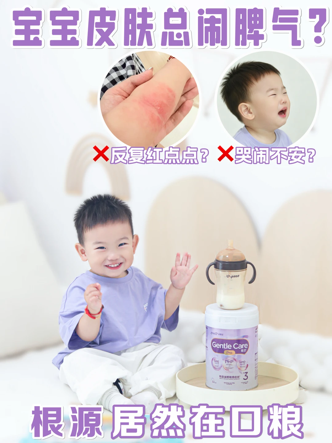 宝宝皮肤总闹脾气❓根源居然在口粮！‼️