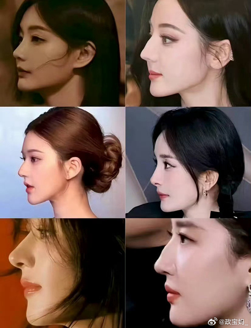 内娱顶美女明星的颌面展示，你觉得谁更胜一筹呢？反正我觉得争议最大的那个人真的还蛮好看的啊[笑cry] ​