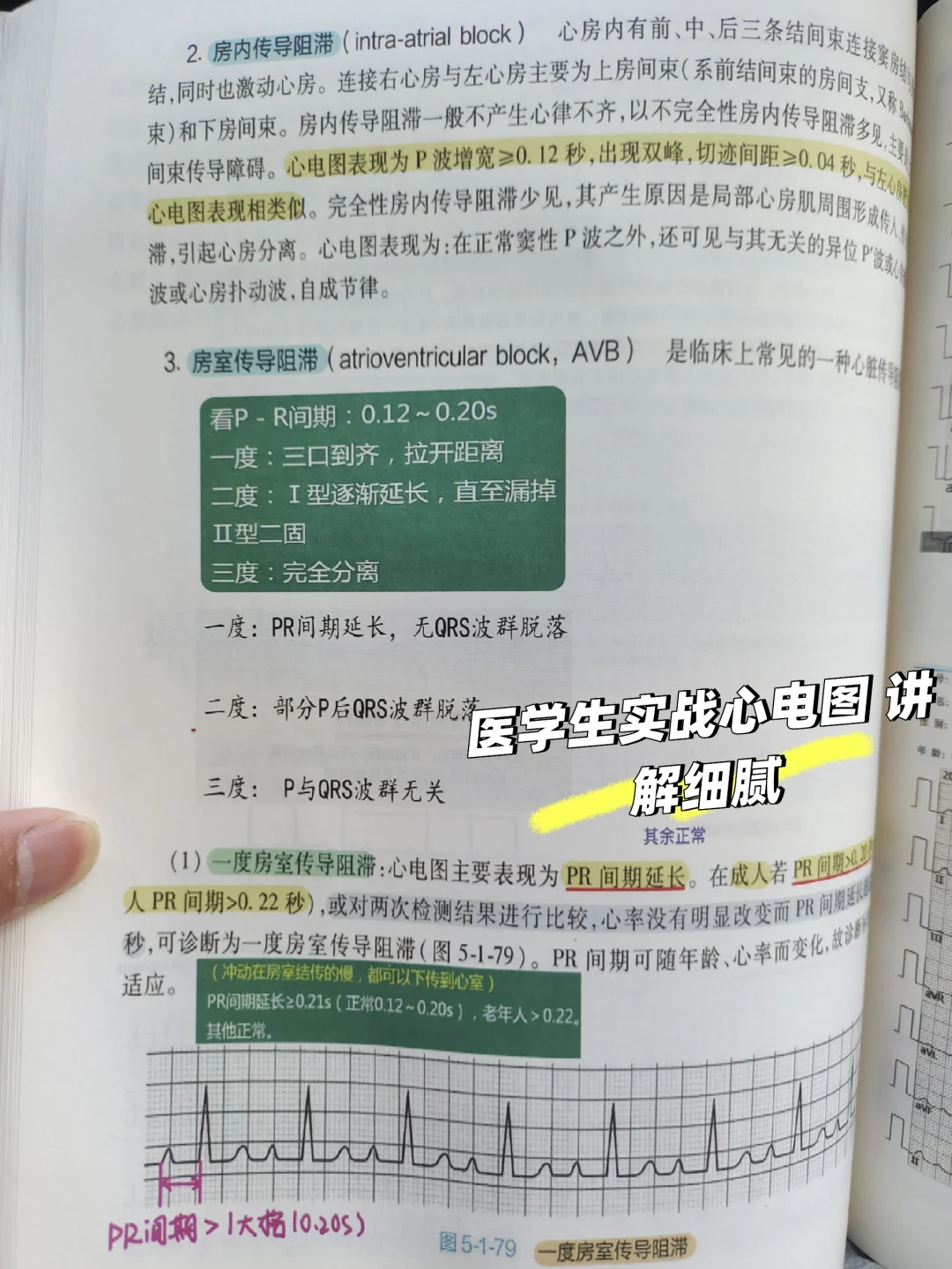 规培心电图笔记