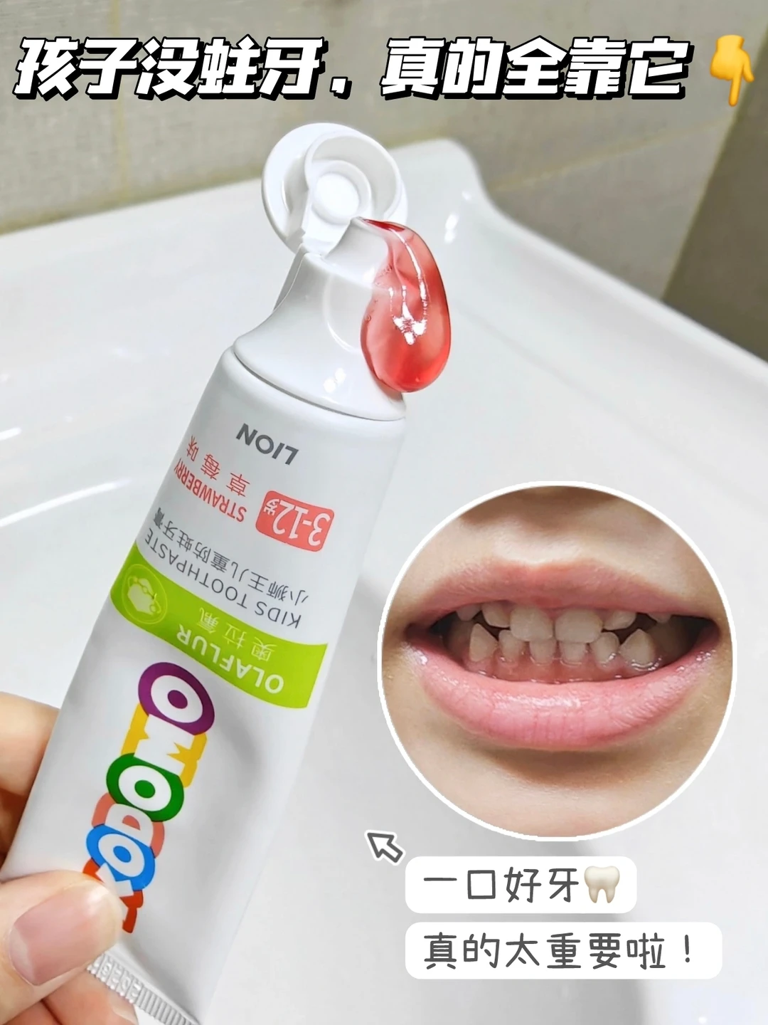 🔥警惕宝宝乳牙龋齿！预防蛀牙太重要