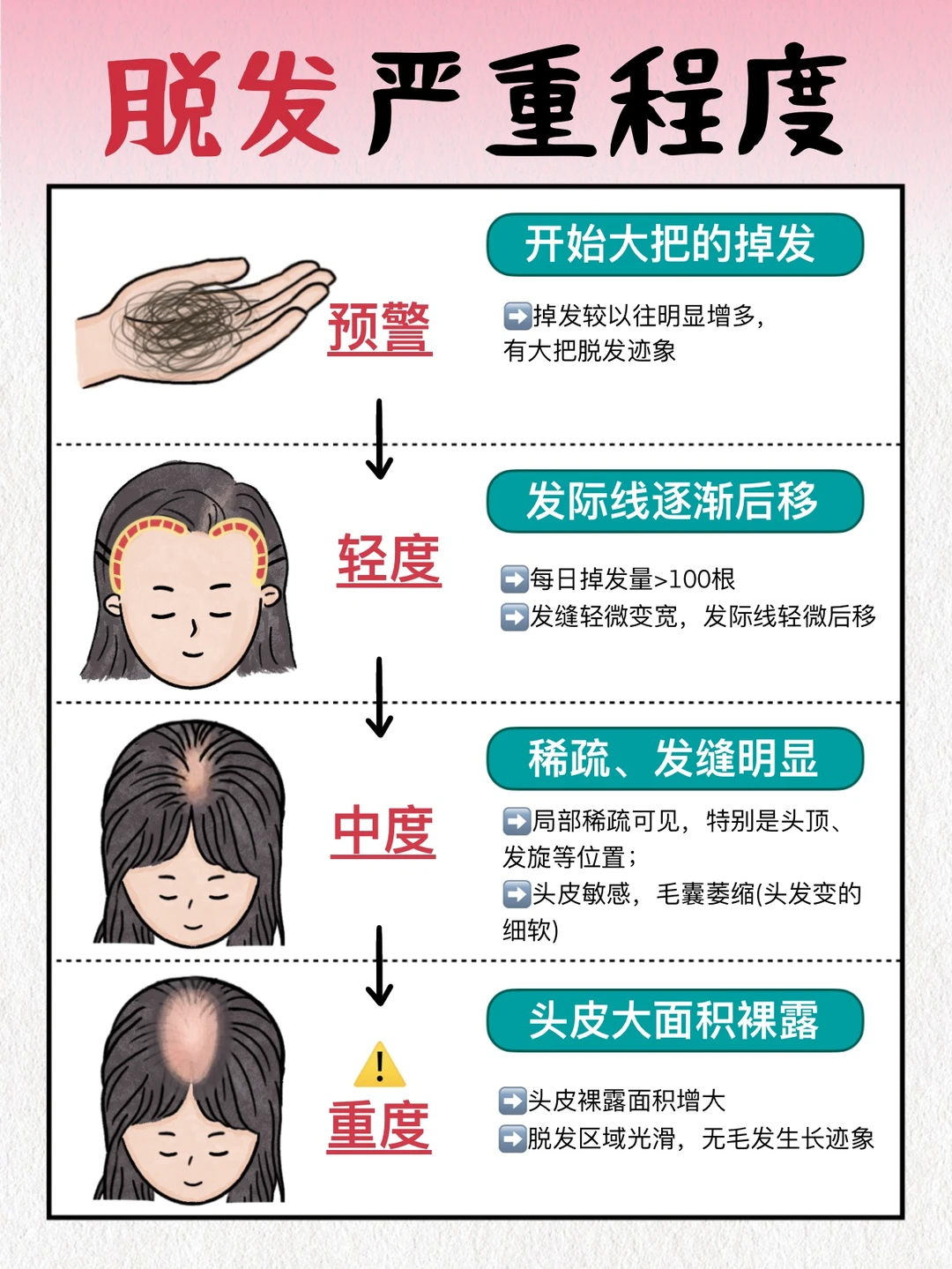 防脱一定要趁早！不同阶段解决思路有区别
