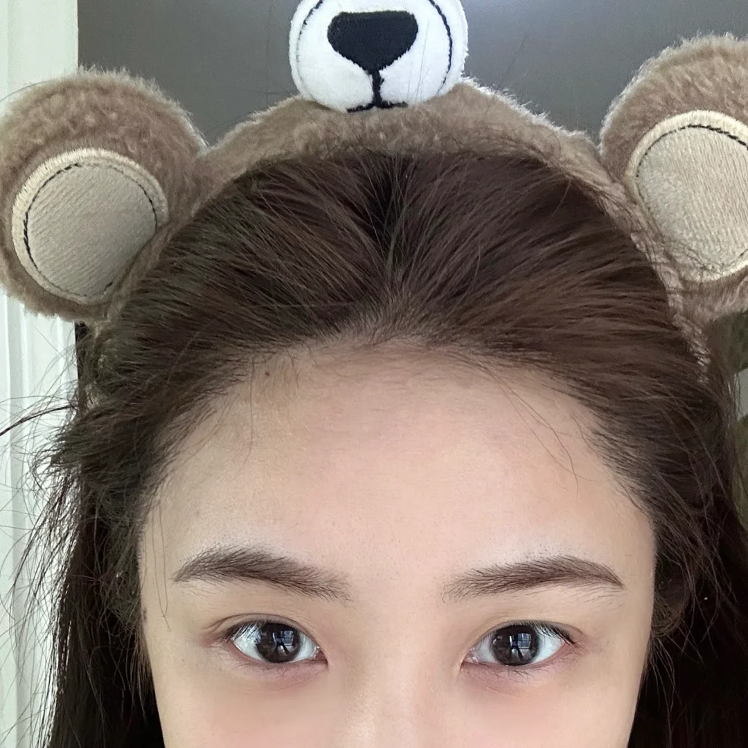 谁能看出这是植发半年的头发！好爱我发际线